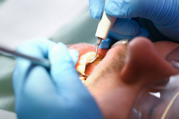 Best Pediatric Emergency Dentist in Washingtonville, NY