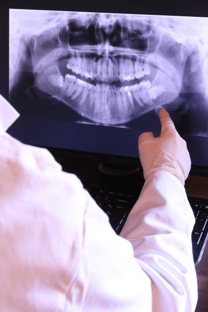 Best Emergency Dental Care for Broken or Chipped Teeth in Washingtonville, NY